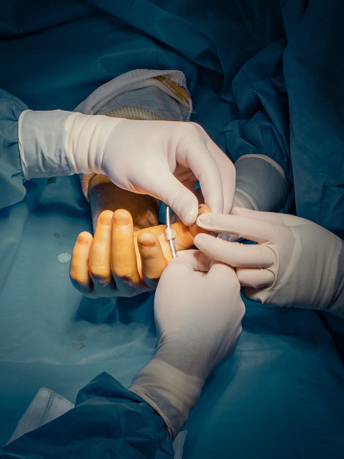 3 months in a surgery room.